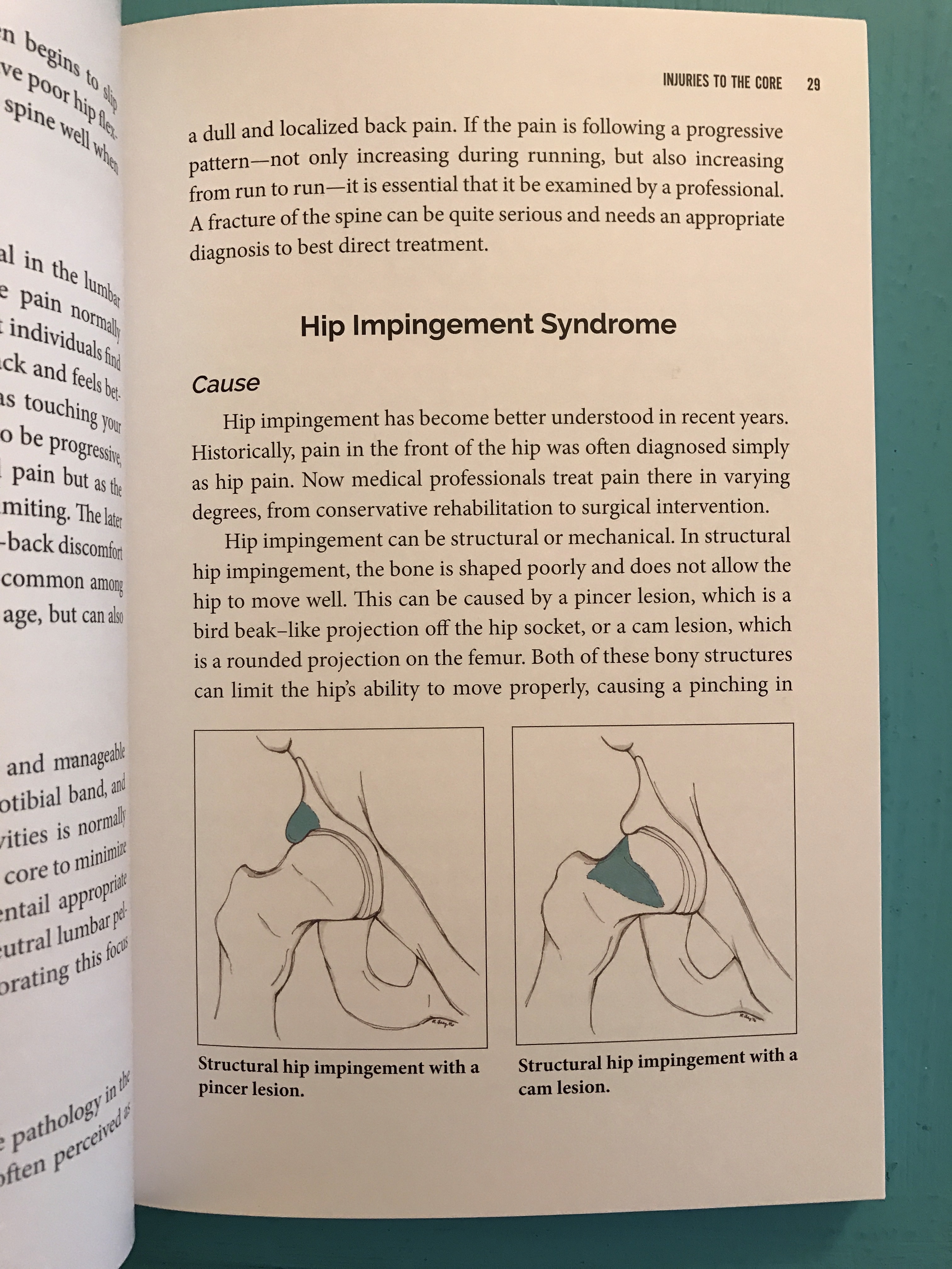 Runner's Guide to a Healthy Core